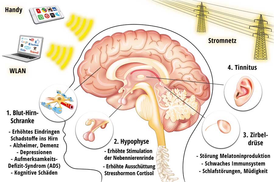 Handy-, WLAN Strahlung und Schäden am Gehirn